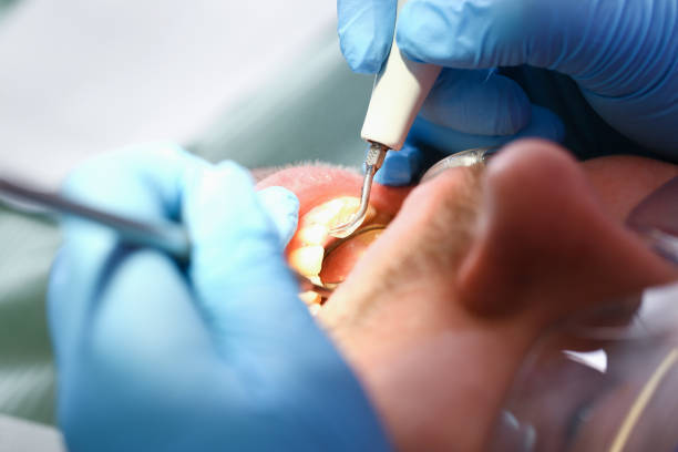 Best Emergency Gum Pain Relief  in Cibolo, TX