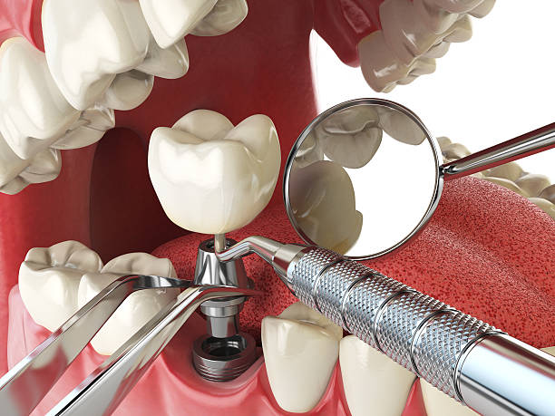 Best Knocked-Out Tooth Emergency  in Cibolo, TX